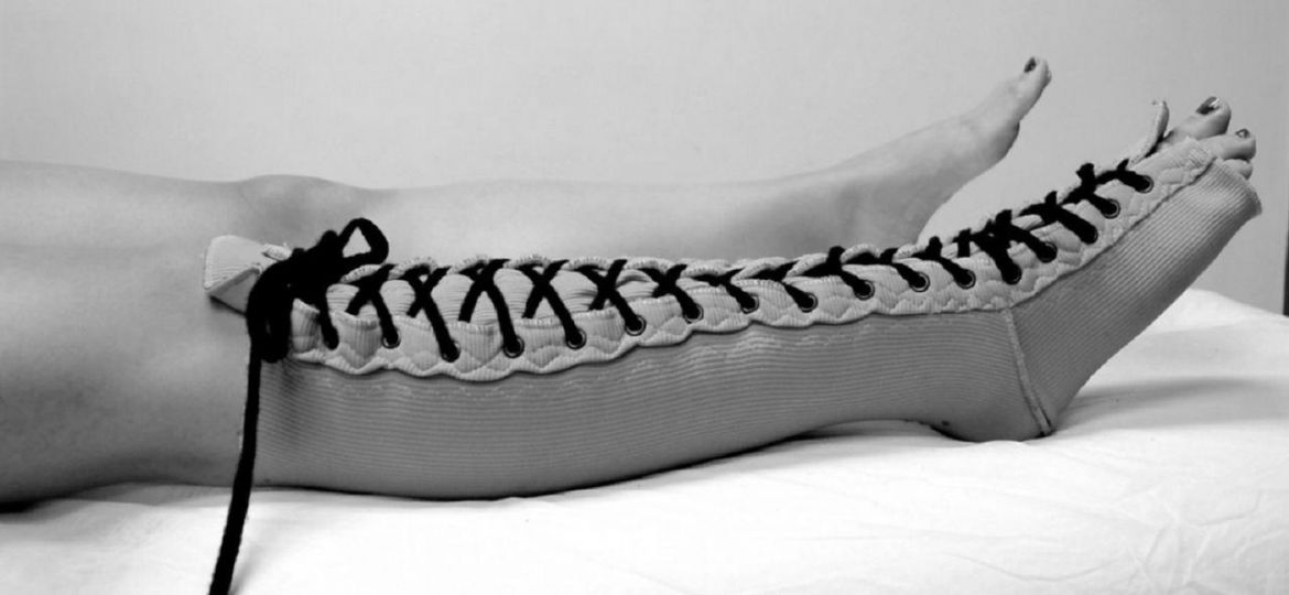 Fisioterapia y linfedema
