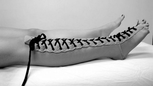 Fisioterapia y linfedema