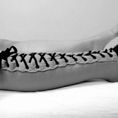 Fisioterapia y linfedema
